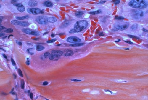 national-cancer-institute-SP2C8o2EZBw-unsplash national-cancer-institute-SP2C8o2EZBw-unsplash